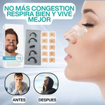 DILATADOR NASAL™